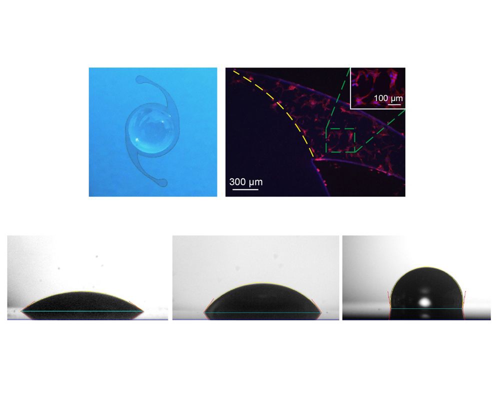 化工系團隊首創全球新型人工水晶體-封面圖