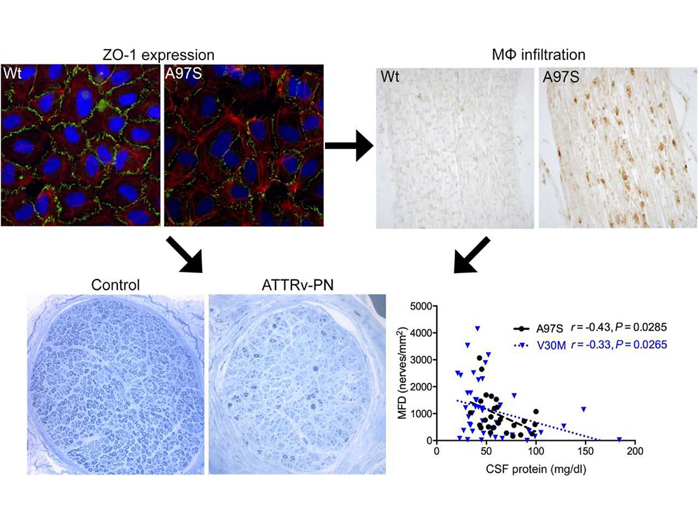 揭示TTR-A97S突變導致神經-血管障蔽滲漏與神經發炎的新機制-封面圖